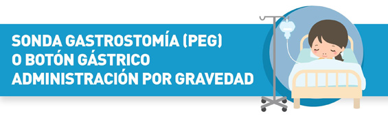 Sonda gastrostomía o botón gástrico